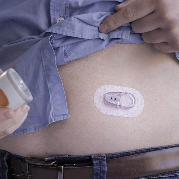 Dexcom ONE Sensor 3 Pack and Transmitter